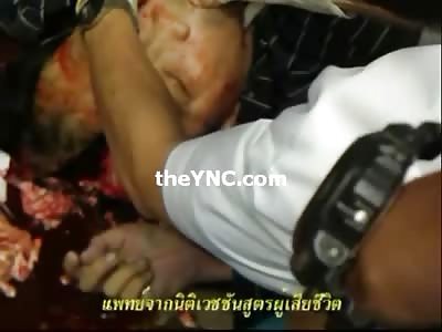 Suicide Man Splattered on the Ground Head Cracked Open