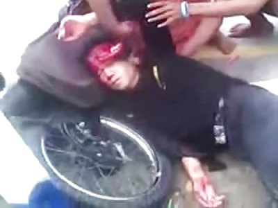 Man in Pain is Scalped From Horrible Accident... Woman Trying to Pin it Back to his Head