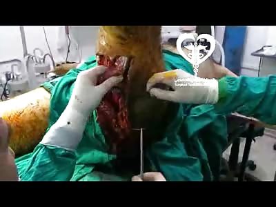 Dudes Leg is Like Looking at a Ground Beef Slab