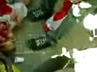 Man Shot in the Head Slowly Dies on Camera.....Cameraman Loves the Closeup