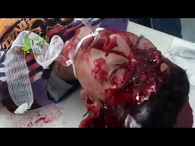 Little Kid shot in the Head Struggling to Stay Alive