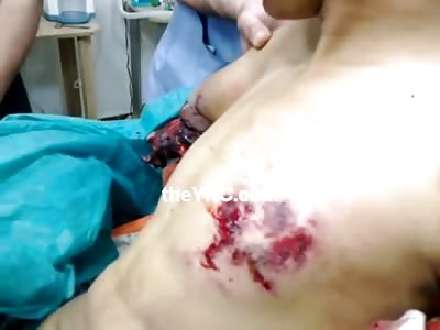 Kid with Both His Arms Blown to Bits Seems Pretty Damn Calm