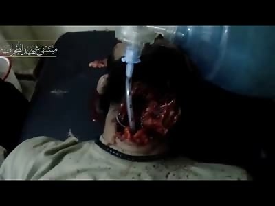 Breathing Tube inside the Throat of Man with Huge Trauma to the Neck