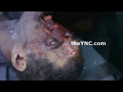 Man Rear Ended a Truck now a Cold Frozen Smashed Face