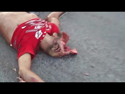 Absolutely Horrific Motorcycle Accident Leaves this Dude Smushed But his Fat Girlfriend Only Scratched Up