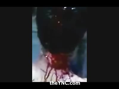 How do I look? Checking yourself out in the Mirror after getting your Ass Kicked with a Machete