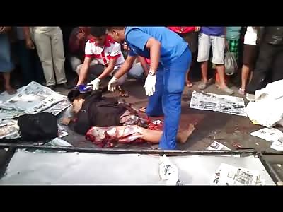 Man Completely Dismembered in Accident is Moved onto Gurney in Pieces 