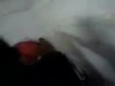 Horribly Burned Thief Agonizes in Hospital Room