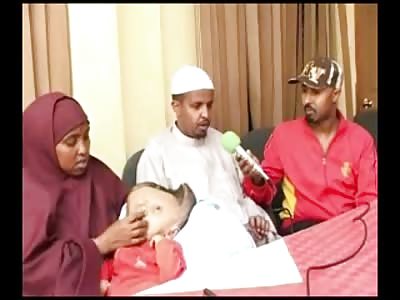 Sad Video of Poor Boy born with Giant Flat Head. His Parents asking for Help