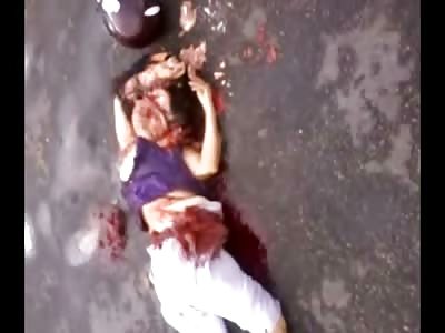 Woman's Face Smashed after Motorcycle Accident