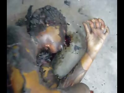 Really Depressed Woman Commits Suicide by Fire Aftermath