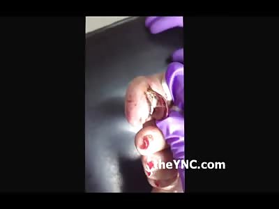 Woman with Pretty Red Toenails...with Maggots living Underneath them 