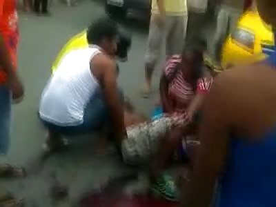 Poor Guy with Gruesome Exploded Leg Injury in Hell of a lot of Pain