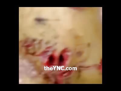 Here's what a body looks like after being stabbed 50x