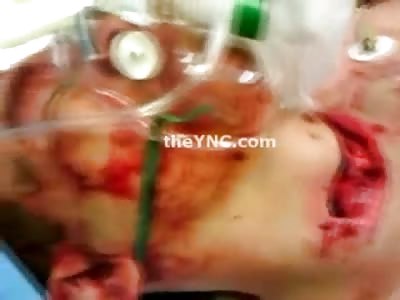 Gutted like a Fish in the Throat and Stomach, Trachea is Moving as he Breathes