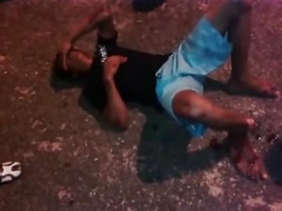 Man in Pain Doesn't Want to Look at his Snapped in Half Leg