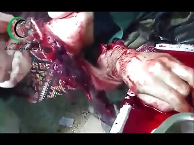 Doctor saws off the Hand of a Groaning Patient...Gross