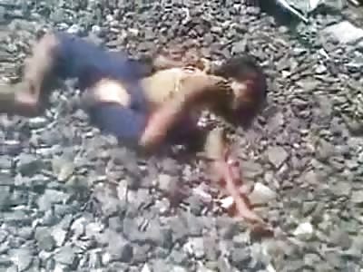 Little Lady with Foot in her Mouth after Train Accident