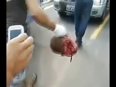 Man Decapitated in Motorcycle Accident has his Head carried down the Road by the Earlobe