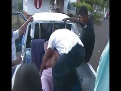 Man Horribly Disfigured in Motorcycle Crash still Alive