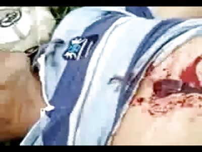 Man Slowly Dies from Bubbling Stab Wound to the Solar Plexus, Cell Phone records the Entire Process