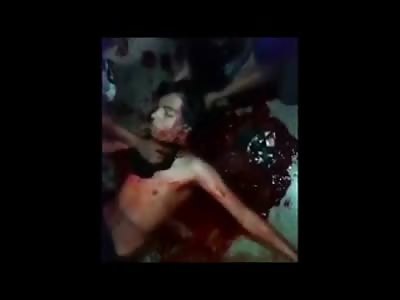 Boy losing Way too Much Blood takes Final Reflexive Gasps