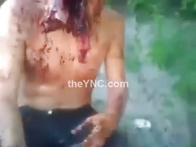 Extraordinary Footage of Mans Face Blown off Still Alive, trying to Drink Water and Giving the 