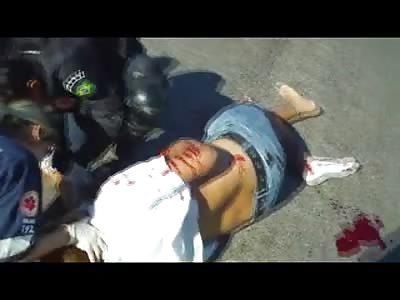 Man's Body Gets a Little Twisted up from Accident