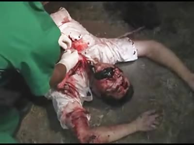 Couples Horribly Fucked up Bodies after Accident