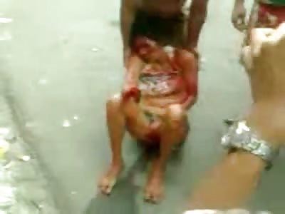 Woman Hand Cut off by Crazy Husband for Name Calling his Mother