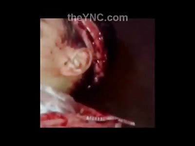 Poor Kid is Left Dead from Machete Blow to the Head 