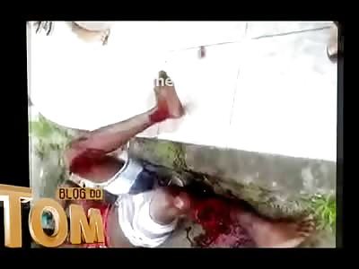 Screaming Man with Flopping Leg needs to Calm Down