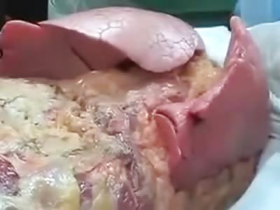 Exquisite Lungs Breathing outside of the Body (New) 