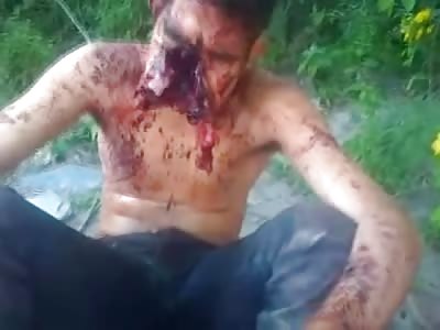 LONGER Much Better Quality Version of the Extraordinary Video of man Alive with His Face Shot Off