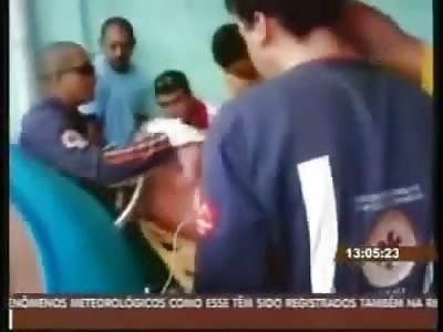 Old Man brought into Hospital with Iron Bar Through and Through his Entire Torso 