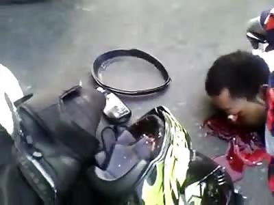 Crowd watches Motorcyclist lying Face First with Eye Dangling out of his Head