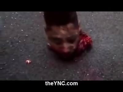 What Would You do with the Head of the Suicide Bomber that Just Blew up Your Friends?