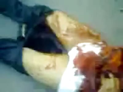 Man Run-over by a Tank Lies in Agony with his Body Nearly Ripped in Half