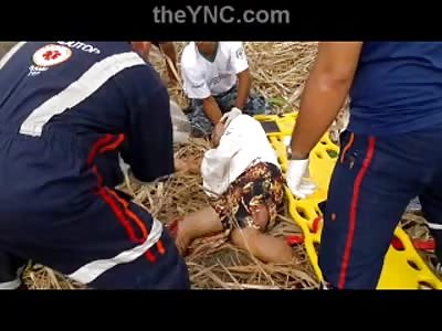 Dudes in Terrible Agony's foot was Ripped off in a Accident