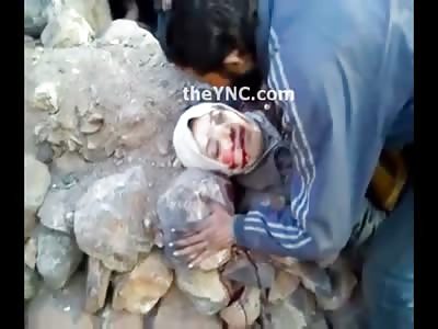 Woman with her Head Exploded lies next to her Sister