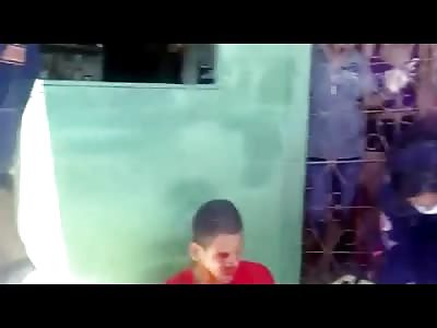 Eye shot out and Waiting Patiently for Help