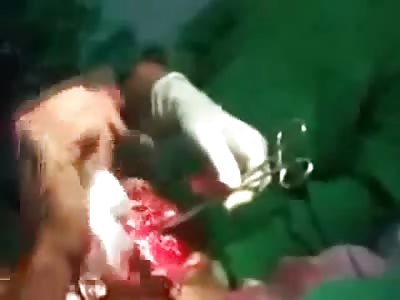 Man in Surgery With Mouth Blown off Trying to Talk to Doctors
