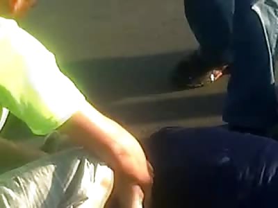 Lower Leg Bone Exposed in this Horrific Accident that Left this Mans Leg Cut in two Pieces 