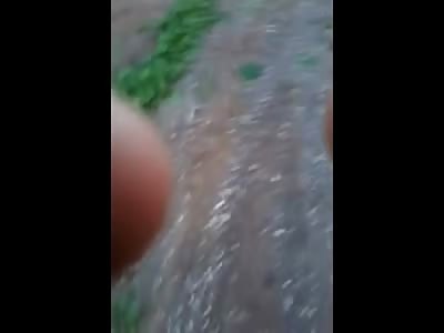 13 year old Boy lost his Left Eye when a Fire goes off in his Face (Watch Slow motion)