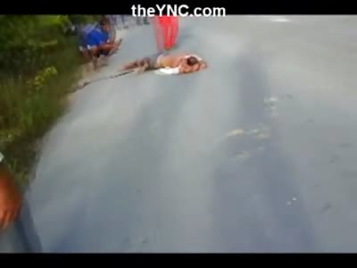 Man in Agony After Being Hit by Car with Leg and Arm Ripped up