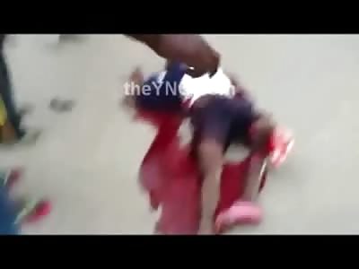 Man in Total Agony, Leg ONLY Connected by a String