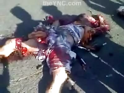 Man Entirely Crushed, Woman in Perfect Condition but Still Dead