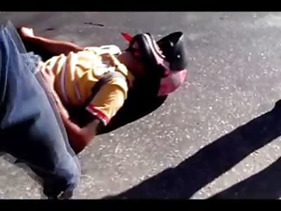 Thief in Terrible Agony after Police Shoot him in the Head