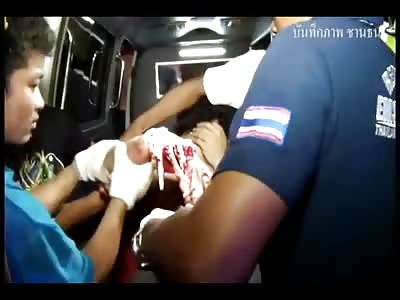 How does this Man Keep Quiet? His Hand is Skinned to the Bone...OUCH