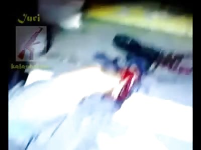 Just Walk that Shit off Dude!